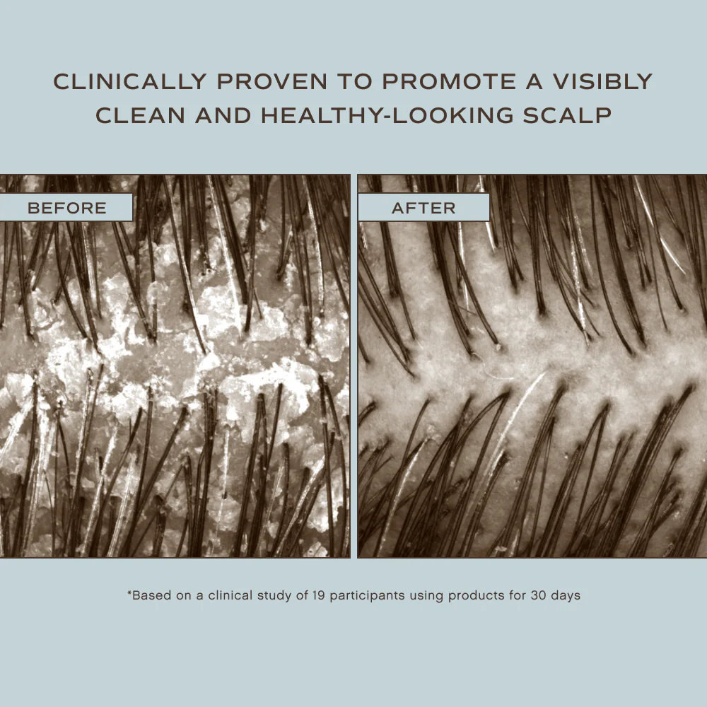Hair Renew Scalp Hairbath - Image 5